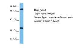 ARHGAP9 Rabbit anti-Human, Polyclonal, Novus Biologicals 0.1 mL | Buy Online | Novus Biologicals | Fisher Scientific
